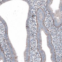 Anti-ME3 antibody produced in rabbit 