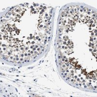 Anti-MEA1 antibody produced in rabbit HPA017921-100UL