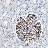 Anti-MED22 antibody produced in rabbit 