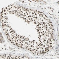 Anti-MED4 antibody produced in rabbit HPA006232-100UL