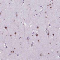 Anti-MEF2C antibody produced in rabbit 