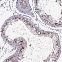Anti-MEIOC antibody produced in rabbit 