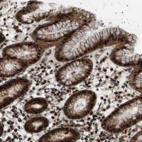 Anti-MELK antibody produced in rabbit 