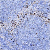 Anti-MERTK antibody produced in rabbit HPA036196-100UL