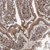 Anti-MESDC2 antibody produced in rabbit 