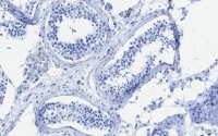 Anti-METTL14 Antibody, clone 2G22 ZooMAb Rabbit Monoclonal 