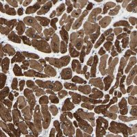 Anti-METTL16 antibody produced in rabbit 