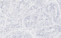 Anti-METTL7A Antibody, clone 1O8 ZooMAb Rabbit Monoclonal 