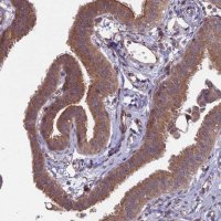 Anti-MFSD8 antibody produced in rabbit 