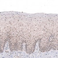 Anti-MGA antibody produced in rabbit 