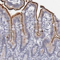 Anti-MGAM antibody produced in rabbit 