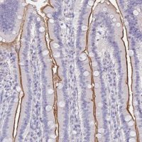 Anti-MGAM2 antibody produced in rabbit 