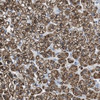 Anti-MGARP antibody produced in rabbit 