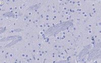 Anti-mGluR5 Antibody, clone 1F11 ZooMAb Rabbit Monoclonal 