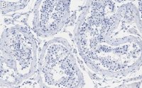 Anti-MGMT Antibody, clone 2N19 ZooMAb Rabbit Monoclonal 
