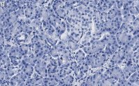 Anti-MICA Antibody, clone 4F8 ZooMAb Rabbit Monoclonal 