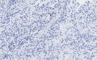 Anti-MICB Antibody, clone 2K9 ZooMAb Rabbit Monoclonal 