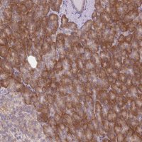 Anti-MINK1 antibody produced in rabbit 