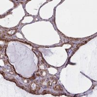 Anti-MINOS1 antibody produced in rabbit 