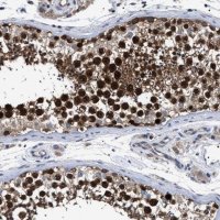 Anti-MIS18A antibody produced in rabbit HPA020585-100UL