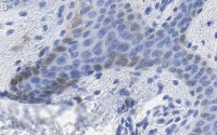 Anti-MITF Antibody, clone 1E2 ZooMAb Rabbit Monoclonal 