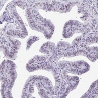 Anti-MKI67IP antibody produced in rabbit 