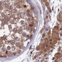 Anti-MKKS antibody produced in rabbit HPA041071-100UL