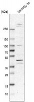 Anti-MKNK2 antibody produced in rabbit 