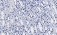Anti-MLL/HRX CT Antibody, clone 5C15 ZooMAb Rabbit Monoclonal 