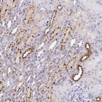 Anti-MMACHC antibody produced in rabbit HPA027402-100UL