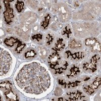 Anti-MMGT1 antibody produced in rabbit 