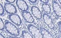 Anti-MMP-14 Antibody, clone 1J5 ZooMAb Rabbit Monoclonal 