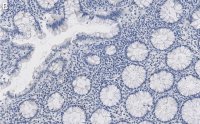 Anti-MMP14 Antibody, clone LEM-2/15.8 ZooMAb Mouse Monoclonal 