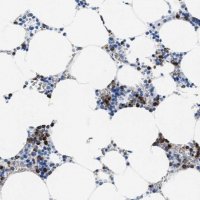 Anti-MMP8 antibody produced in rabbit 