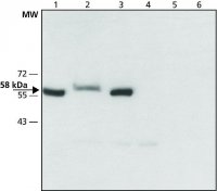 Anti-Monoamine Oxidase B (C-terminal) antibody produced in rabbit 