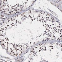 Anti-MORC2 antibody produced in rabbit 