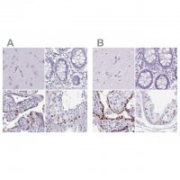Anti-MORC4 antibody produced in rabbit 
