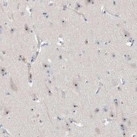 Anti-MPHOSPH10 antibody produced in rabbit 