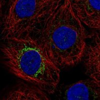 Anti-MPP2 antibody produced in rabbit 