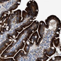 Anti-MPP3 antibody produced in rabbit HPA021818-100UL