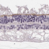 Anti-MPP5 antibody produced in rabbit 