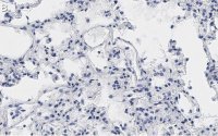 Anti-MRC1 Antibody, clone 1C9 ZooMAb Rabbit Monoclonal 