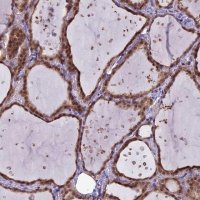 Anti-MRI1 antibody produced in rabbit 
