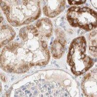 Anti-MRM3 antibody produced in rabbit 