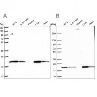 Anti-MT-CO2 antibody produced in rabbit HPA051505-100UL