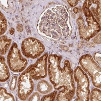 Anti-MTHFD1L antibody produced in rabbit 