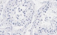 Anti-mTOR Antibody, clone 4O5 ZooMAb Rabbit Monoclonal 