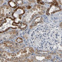Anti-MTX1 antibody produced in rabbit HPA011543-100UL