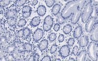 Anti-MUC1 Antibody, clone 1F23 ZooMAb Rabbit Monoclonal 