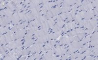 Anti-MYH1 Antibody, clone 1E15 , ZooMAb Rabbit Monoclonal 